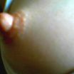 nipple