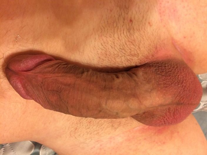 после эпиляции