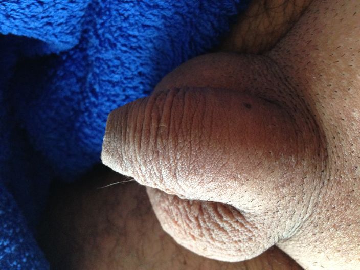 123