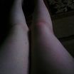 My Legs
