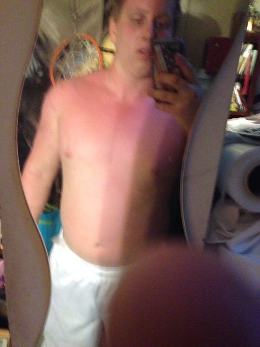slightly sunburned