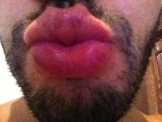 Kiss lips