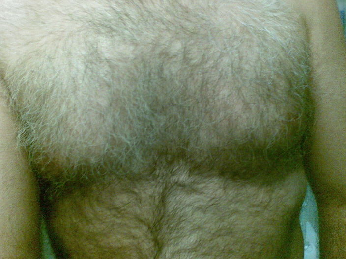 My hairy chest