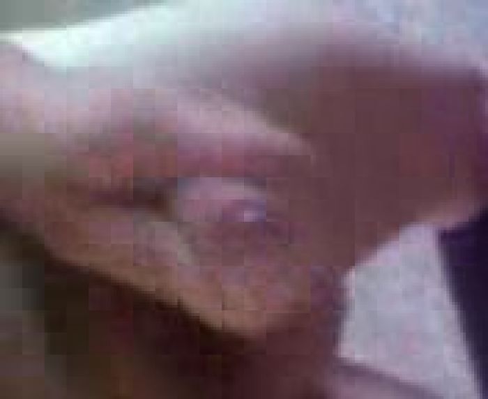 Каму брызнуть