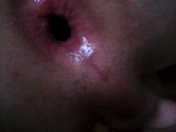 Анальчик  себя