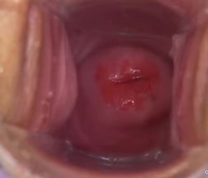 БЛЯДСКИЙ ПОТРОХ